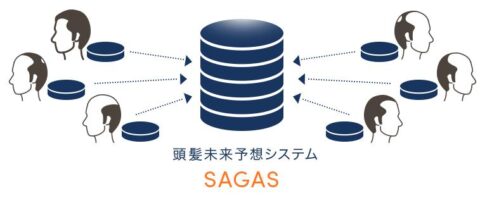 オーダーメイド発毛治療