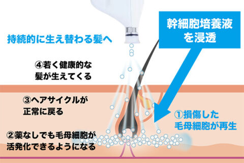 高濃度 ヒト臍帯血細胞順化培養液